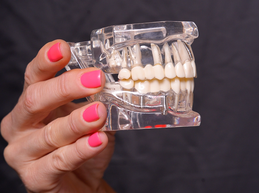 Mano sujetando dentadura